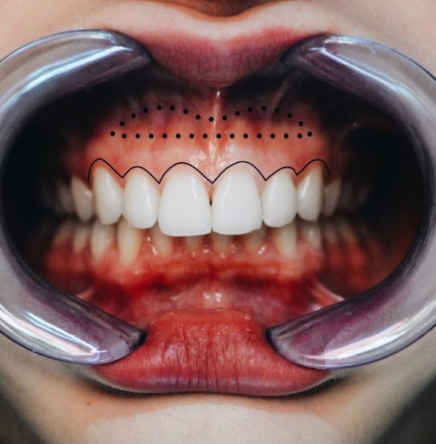 RD Formations cycle esthetique sourire