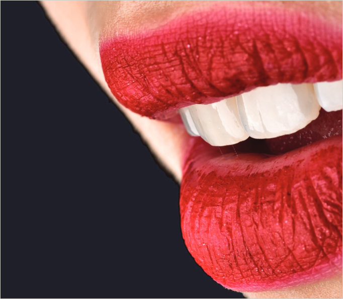 RD Formations cycle esthetique dentaire livret opus