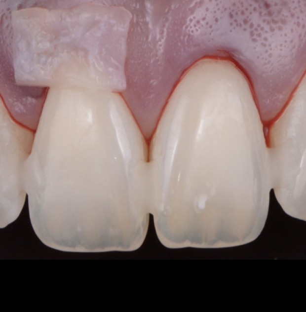 RD Formations secteur anterieur